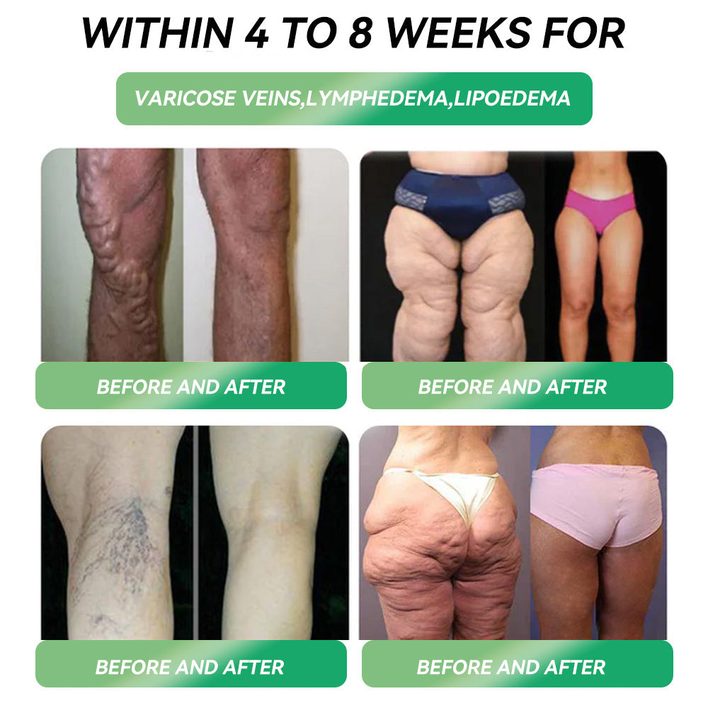 𝑶𝒇𝒇𝒊𝒄𝒊𝒂𝒍 𝑺𝒕𝒐𝒓𝒆 | 👨‍⚕️ 𝐺𝐿𝑃-𝟏  𝐒𝐢𝐱 𝐢𝐧 𝑶𝐧𝐞 𝐇𝐞𝐚𝐥𝐭𝐡 𝐒𝐨𝐥𝐮𝐭𝐢𝐨𝐧 𝐎𝐫𝐚𝐥 𝐋𝐢𝐪𝐮𝐢𝐝 (𝐉𝐮𝐬𝐭 𝐨𝐧𝐜𝐞 𝐚 𝐝𝐚𝐲, 𝐯𝐢𝐬𝐢𝐛𝐥𝐞 𝐜𝐡𝐚𝐧𝐠𝐞𝐬 𝐢𝐧 𝟕 𝐝𝐚𝐲𝐬） ✨𝐅𝐨𝐫 𝐨𝐛𝐞𝐬𝐢𝐭𝐲, 𝐜𝐚𝐫𝐝𝐢𝐨𝐯𝐚𝐬𝐜𝐮𝐥𝐚𝐫 𝐡𝐞𝐚𝐥𝐭𝐡, 𝐝𝐢𝐚𝐛𝐞𝐭𝐞𝐬, 𝐬𝐥𝐞𝐞𝐩 𝐚𝐩𝐧𝐞𝐚, 𝐆𝐮𝐭 𝐇𝐞𝐚𝐥𝐭𝐡, 𝐣𝐨𝐢𝐧𝐭 𝐢𝐬𝐬𝐮𝐞𝐬, 𝐚𝐧𝐝 𝐦𝐨𝐫𝐞